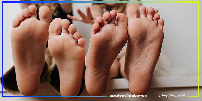 تمرینات مناسب برای اصلاح کف پای صاف