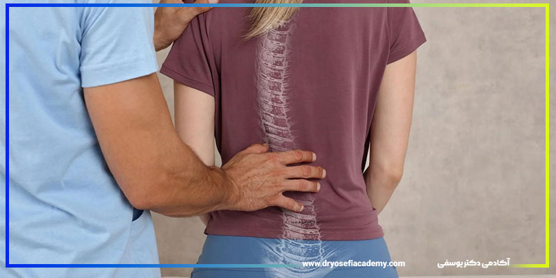 علائم هشداردهنده اسکولیوز
