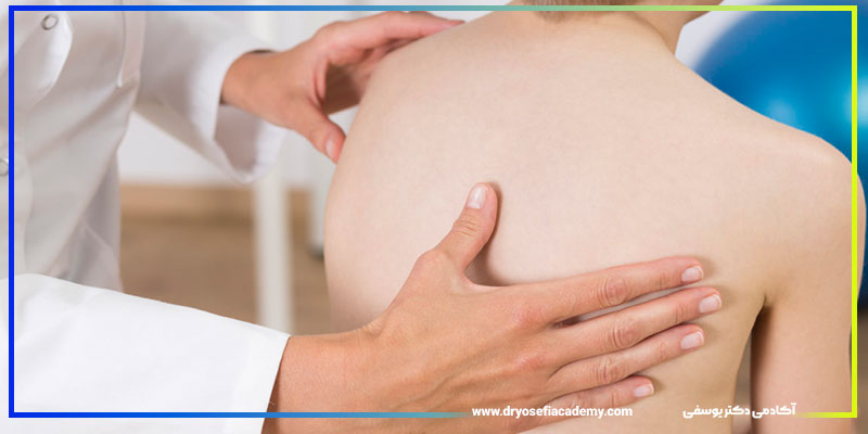 چطور از پیشرفت اسکولیز جلوگیری کنیم؟