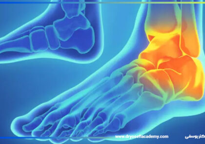 بررسی تخصصی استخوان‌ها و مفاصل مچ پا