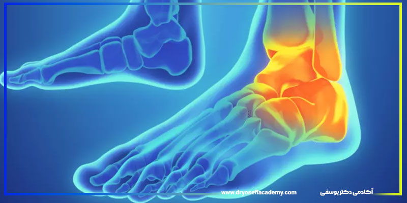 بررسی تخصصی استخوان‌ها و مفاصل مچ پا